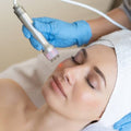 Radiofrecuencia Facial