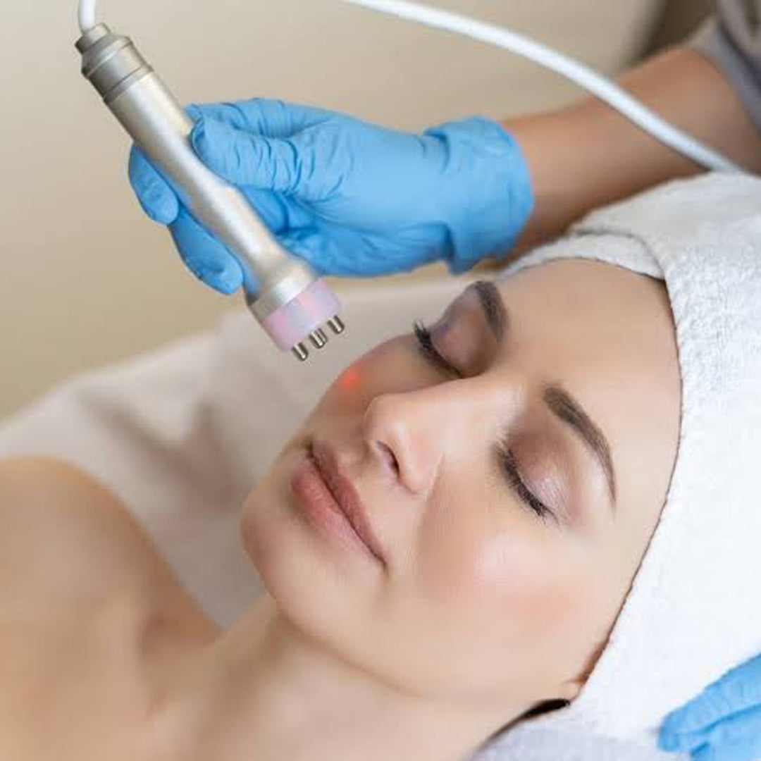 Radiofrecuencia Facial